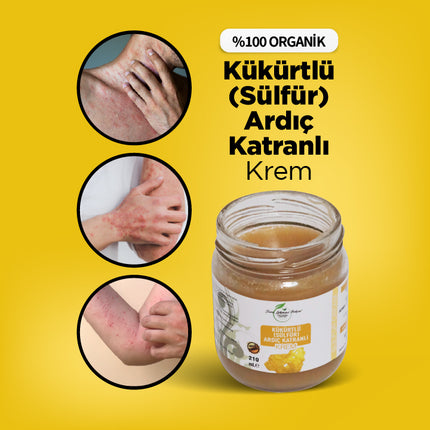 Kükürtlü, Ardıç Katranlı (Kaşıntı Giderici) Krem
